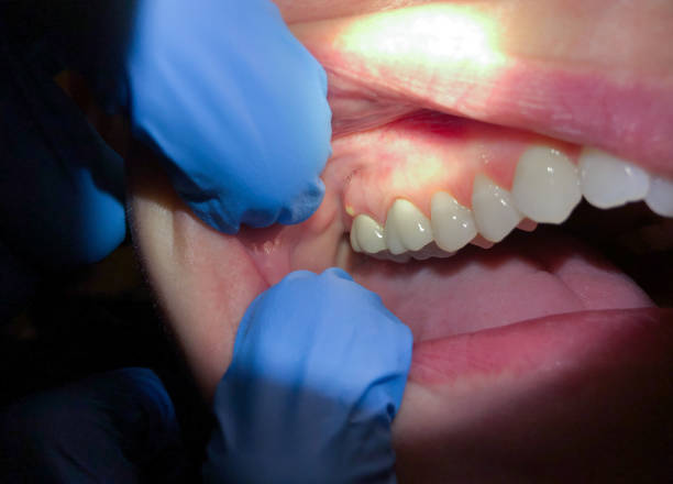 Best Emergency Dentist for Knocked-Out Tooth in Rochelle, IL