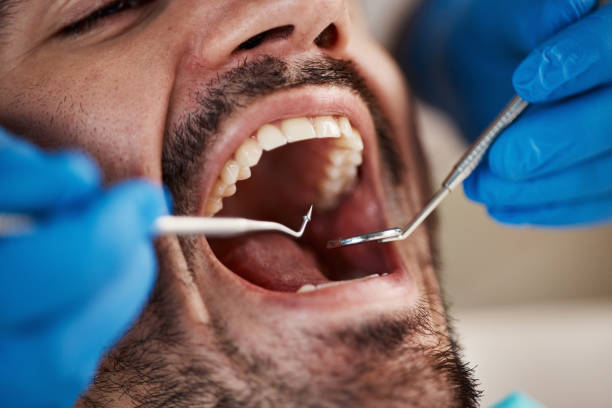 Best Urgent Dental Care for Toothache in Rochelle, IL