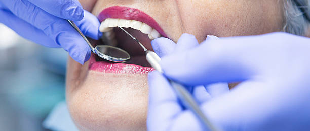 Best Broken or Cracked Tooth Emergency Dentist in Rochelle, IL